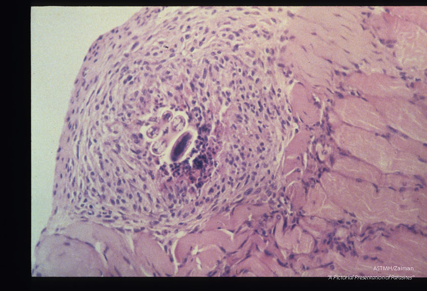 Mouse, BALB/c-Experimental infection as in 1957. Well-organized granuloma containing a coiled larva present within skeletal muscle at 8 months PI. HE, x 200.