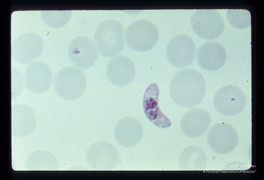 Crescentic gametocytes.