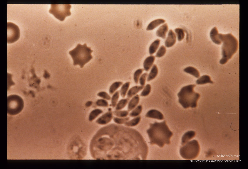 Tachyzoites, free and in macrophages from peritoneal fluid of mouse. Phase, unstained.