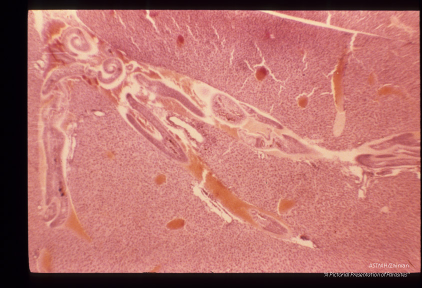 Hepatic portal veins of mouse 28 days after infection.