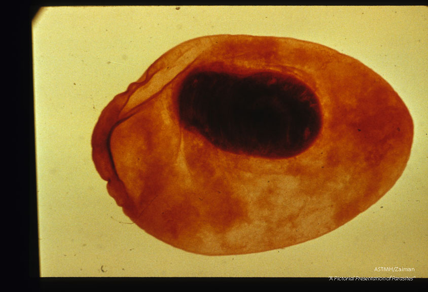 Cysticercus digested free of muscle. Iodine stained.