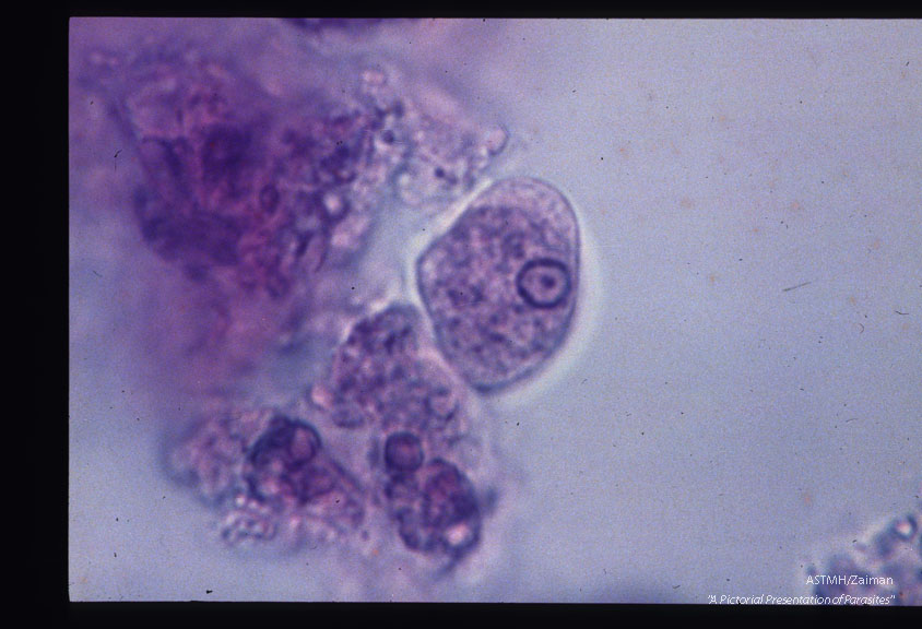 MIF stained trophozoites from a carrier.