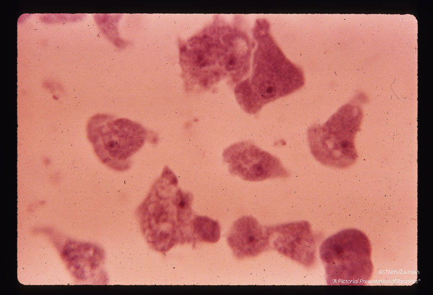 Lee-culture. Hematoxylin stain. Higher power.