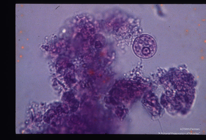 MIF stained trophozoites from a carrier.