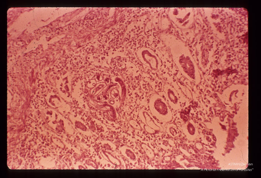 Cross section through adults in human bowel.