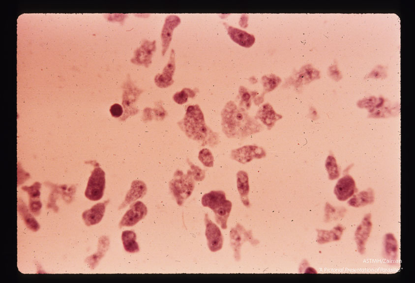 Lee-culture. Hematoxylin stain. Low power.