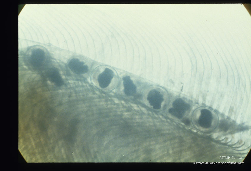 A line of metacercariae are shown on a gill filament.