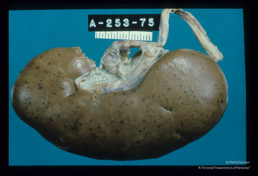 Kidney showing petechial hemorrhages.