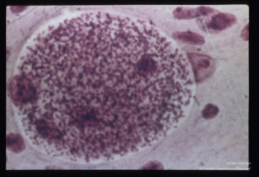 Hematoxylin-eosin stained cyst in mouse brain.