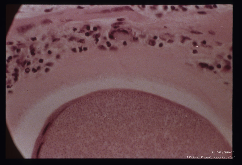 Cysts in striated muscle of reindeer.