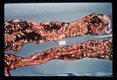 Trichuris tichiura, Balantidium coli,Entamoeba histolytica. Autopsy specimen showing adult helminths, ulcerations and bloody intestinal contents.