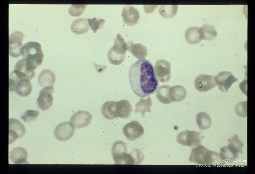 Incorrectly diagnosed as Babesia until proven otherwise with specific stain for iron. (Prussian blue).