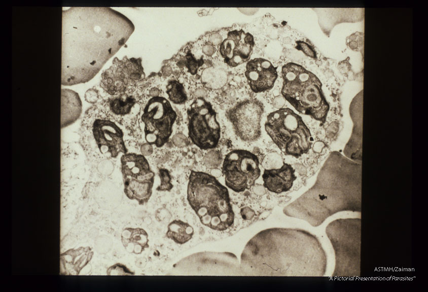 Low power view showing multiple parasitei in a single host cell.