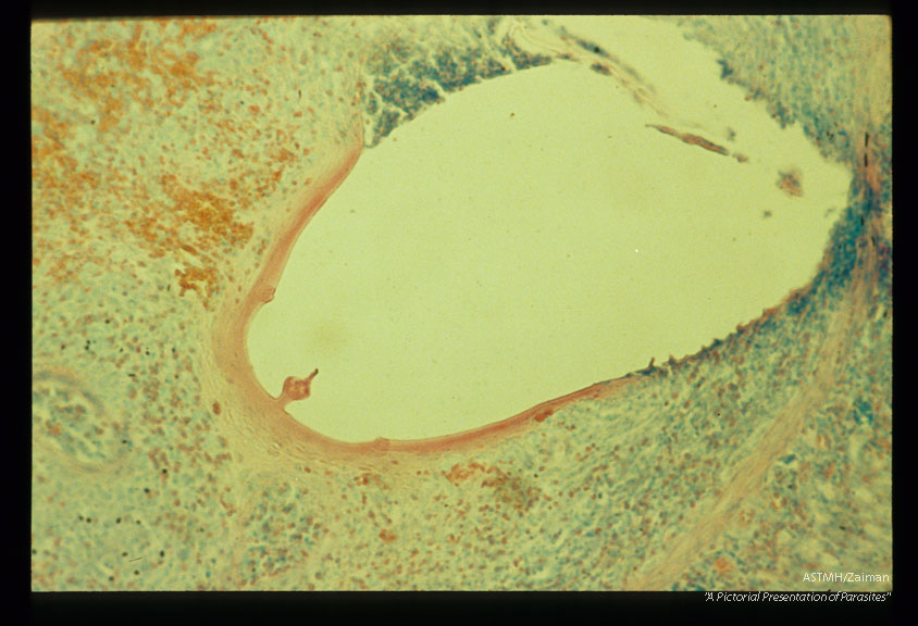 Evacuated attachment cap in the submucosa of an experimentally infected guinea pig.