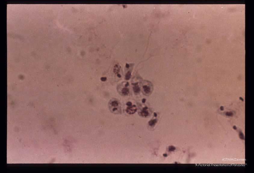 Peru strain forms emerging from infected Hela cells.