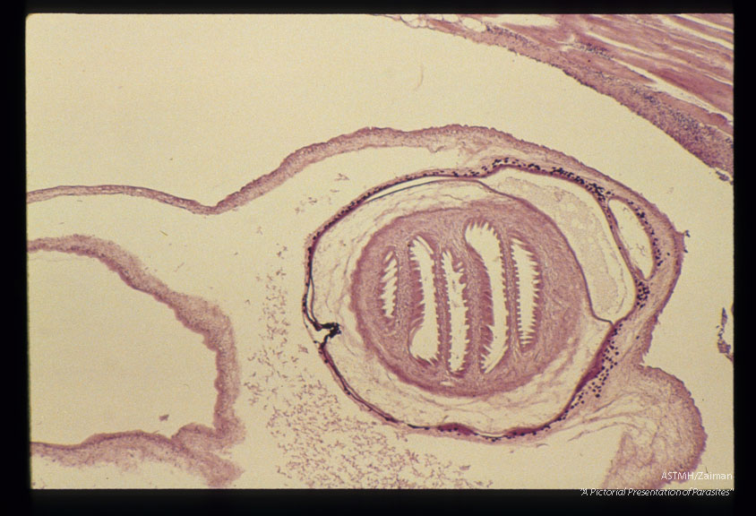 Cysticercus in pig muscle.