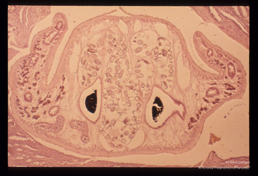 Liver, Cuticular spines, a complicated gut pattern due to multiple branching caeca and characteristic ova differentiate Fasciola from Clonorchis in tissue.