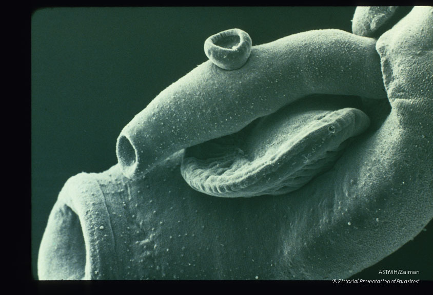 SEM showing anterior portion of male and female.