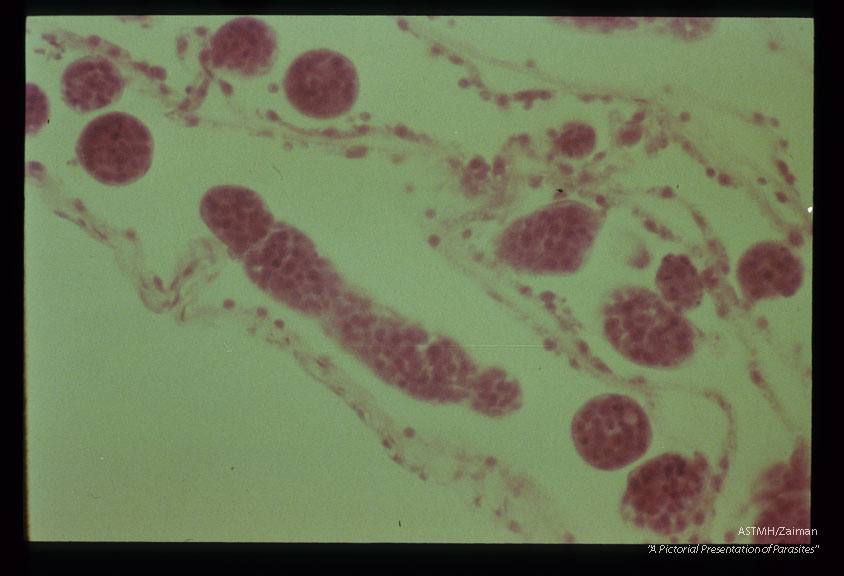 Daughter sporocysts within mother sporocysts in infected Lymnaea catascopium.