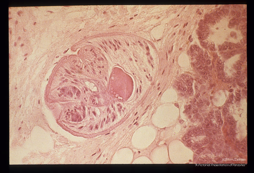 Mesocercarial stage in the connective tissue of mouse mammary gland. Low and high magnifications.