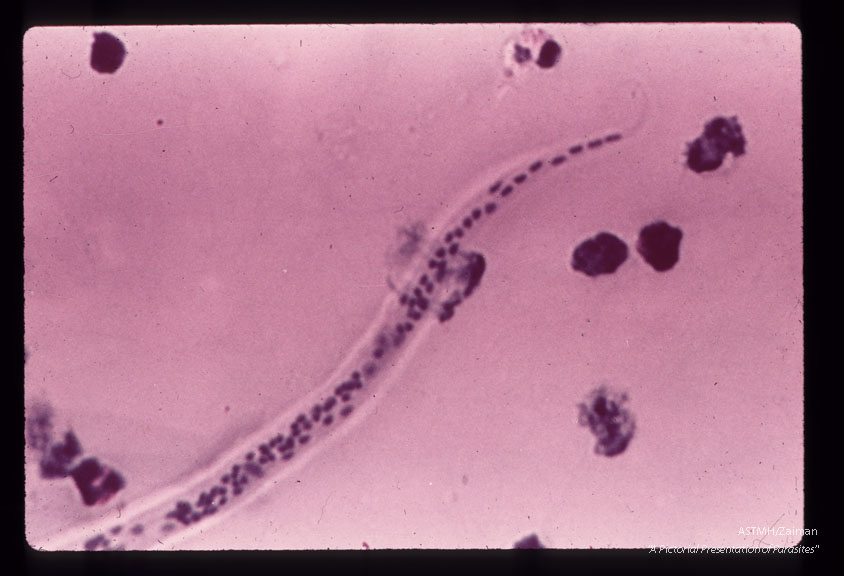 Posterior end of another microfilaria.