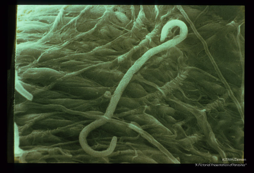 Scanning electron micrographs of microfilariae penetrating the midgut of Aedes aegypti. View is from the hemocoel side of the midgut and it should be noted that microfilariae usually retain their sheath during penetration.