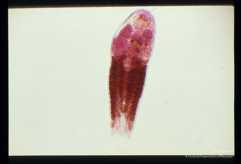 Adult from an experimentally infected cat. Carmine stain.