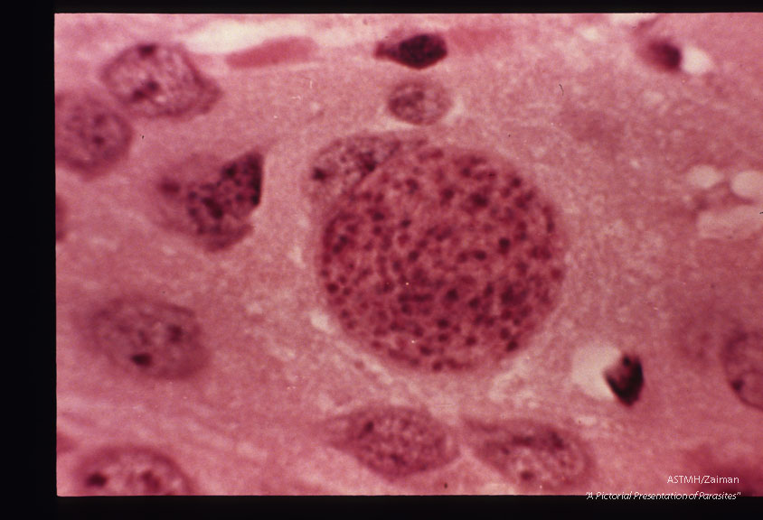 Cyst in uninflamed mouse brain.