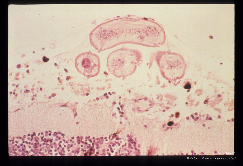 Larva in the inner nerve fiber layer in an experimentally infected squirrel monkey.
