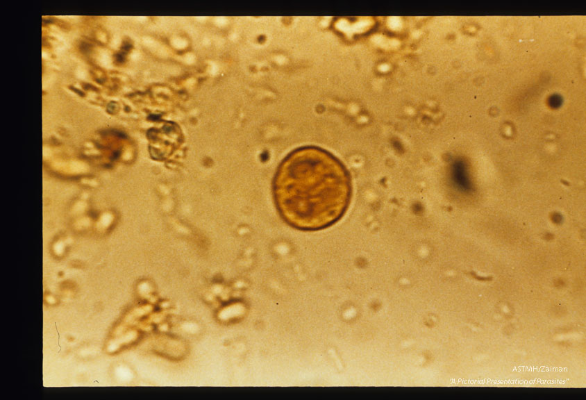 Cysts stained in iodine. Recovered from W.V.U. medical student who had visited and worked in Turkey.