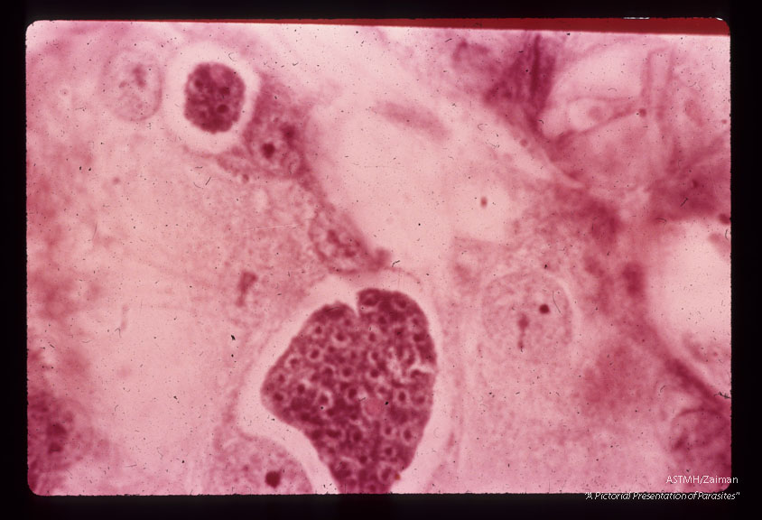 Small and large multinucleate schizonts. Note the refractile globules which persist in first-generation development. H & E stain. (36 hr).
