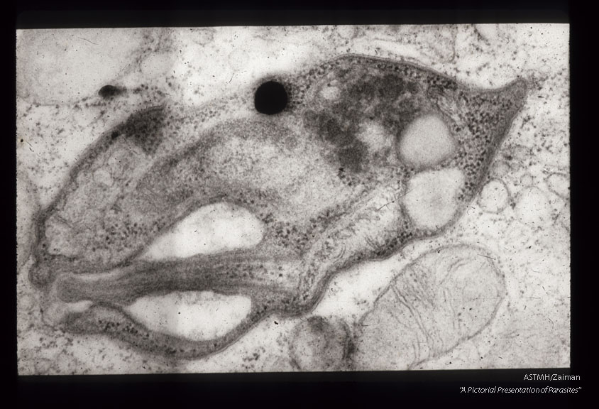 Electron photomicrograph of a parasite in a hamster spleen.