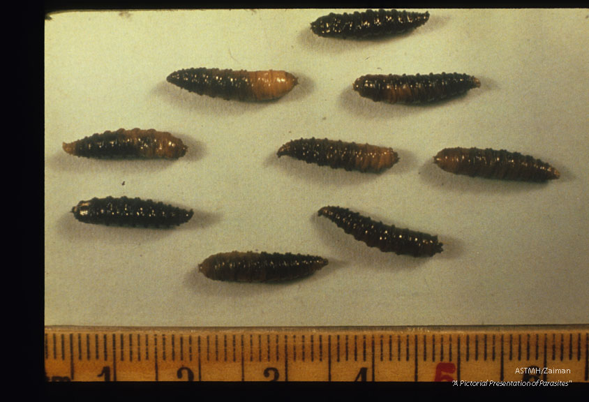 Larvae isolated from the patient.