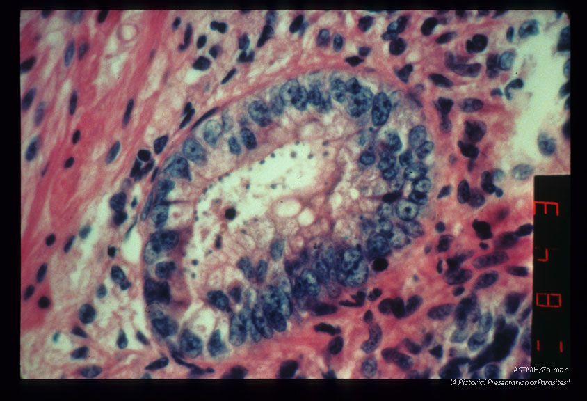 Photomicrographs showing parasites in rectum. H&E stain.