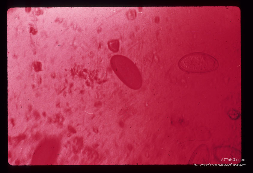 Egg in stool, iodine stain.