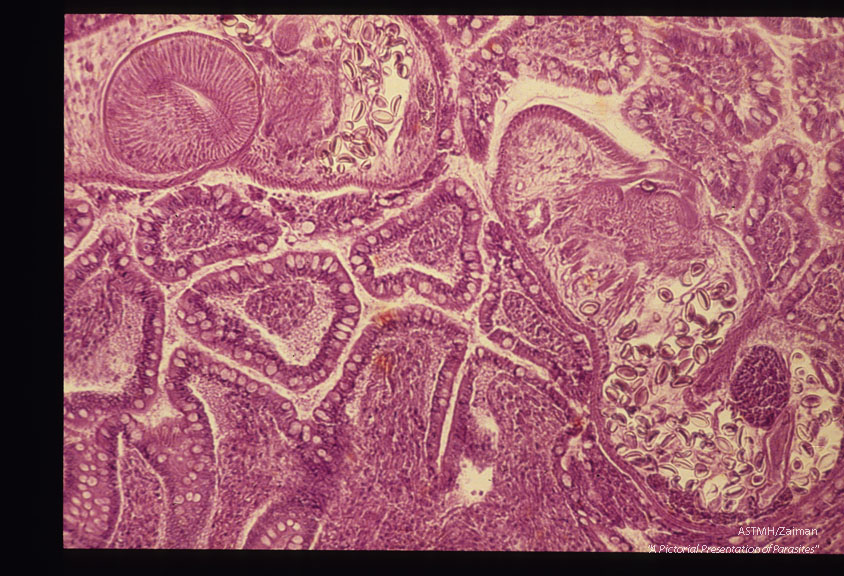 Adult in intestinal wall.