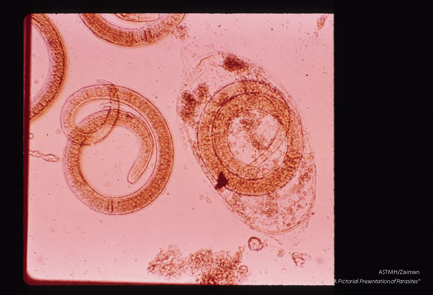 Larvae digested free from muscle. One larvae still partially surrounded by cyst wall.