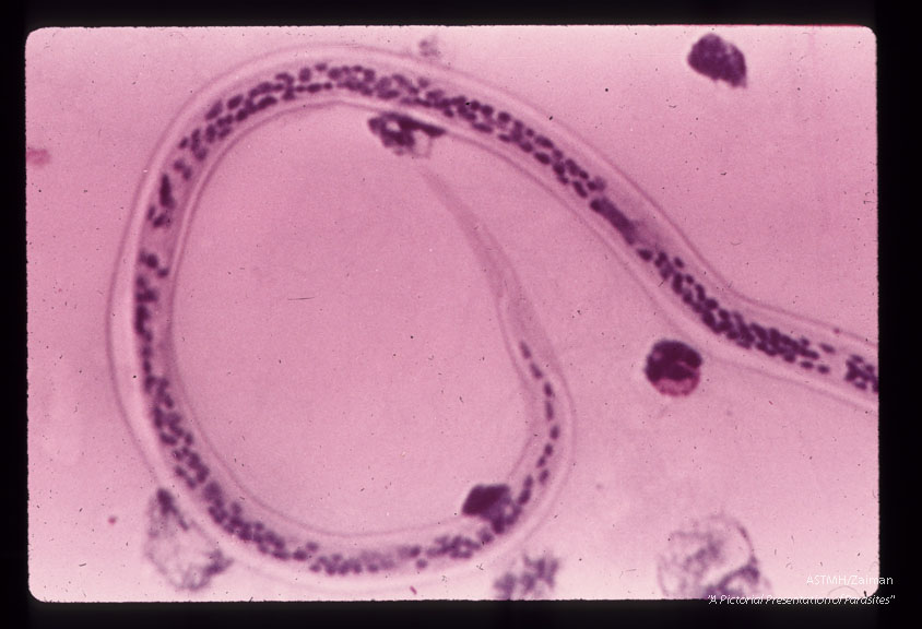 Posterior portion of microfilaria in blood film.