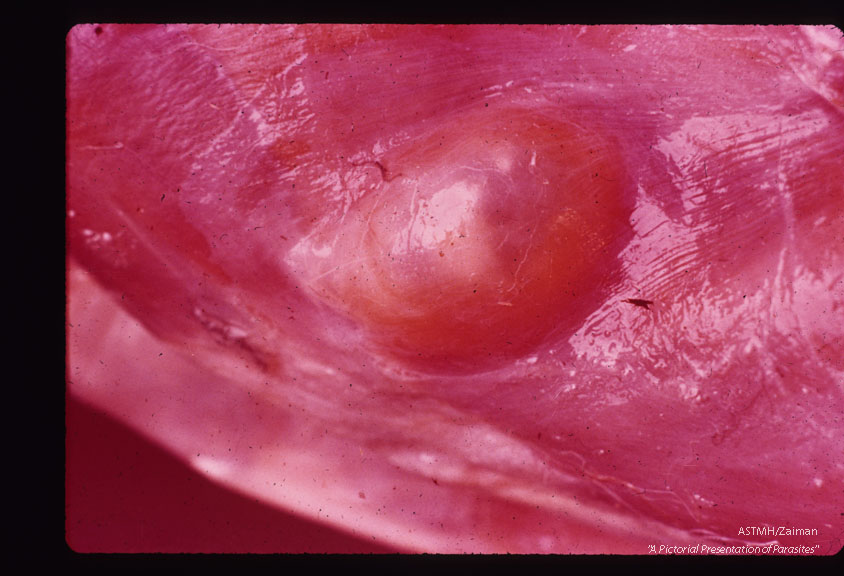 Cyst in rabbit. See slide # 322.