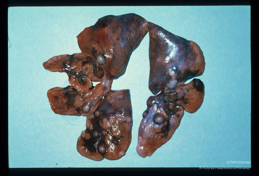 Massive infection showing numerous pulmonary cysts containing adult Paragonimus in a cat exposed to 200 parasites.