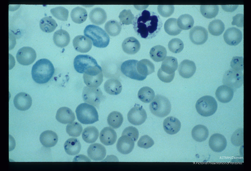 Multiple blood smears from experimental animals infected with material derived from human case.