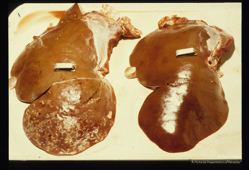 Normal sheep liver and one damaged by migrating larvae.