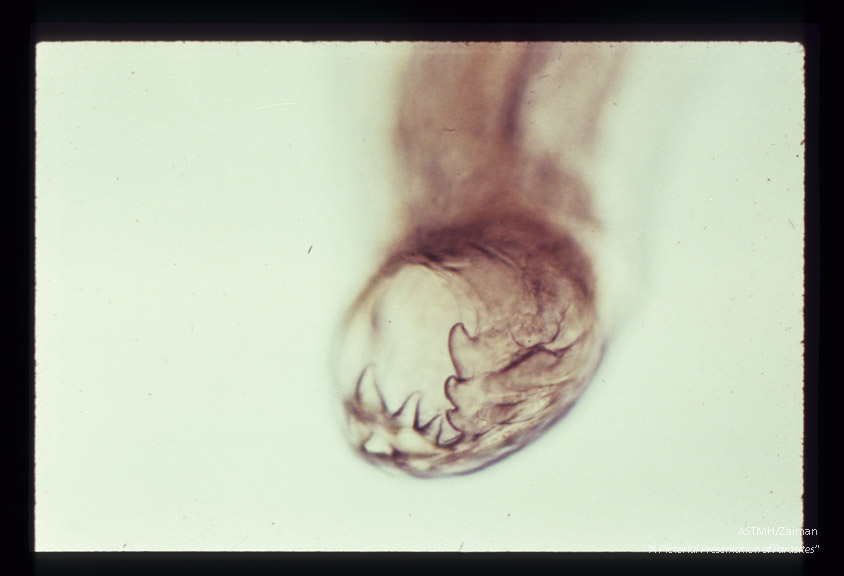 Three pairs of hooks are seen in the mouth of this hookworm.