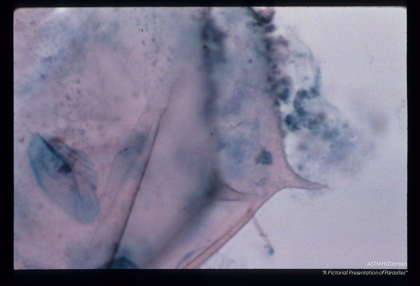 Contaminant found on Pap smear slide.