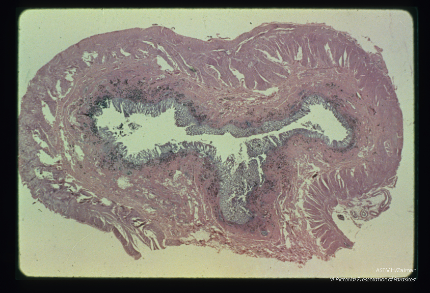 Cross section of bowel wall. This low power view of the bowel in cross section shows one pair of adults in each of two mesenteric veins plus eggs which present as dark spots in the mucosa and submucosa. Compare with slides No. 17 and 18.