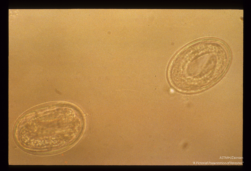 Embryonated, decorticated eggs. These eggs were permitted to develop embryos before being photographed, in order to demonstrate their viability.