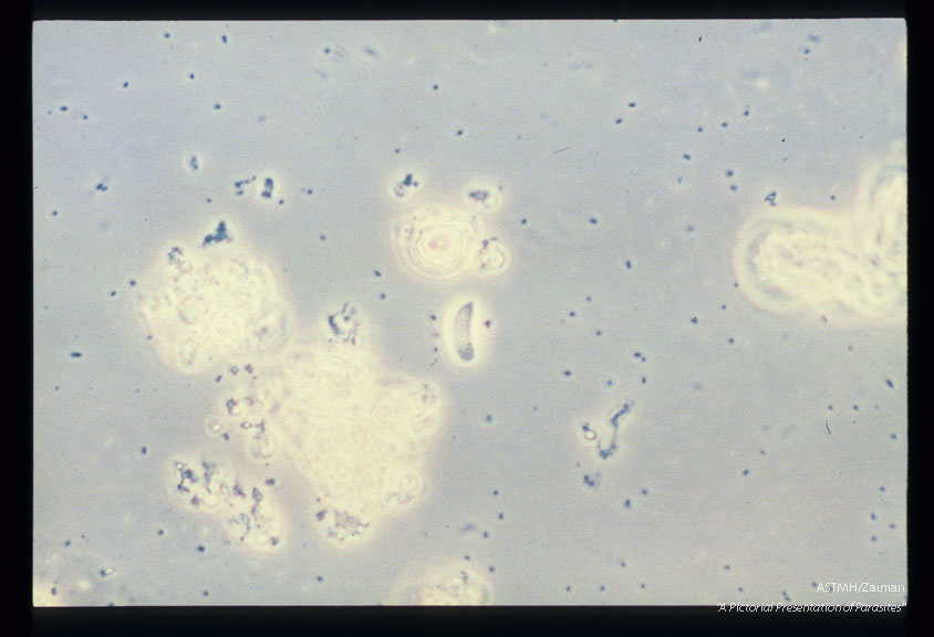 Zoites in hamburger as seen by phase microscopy.