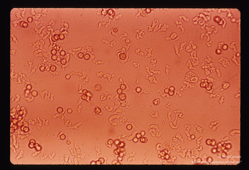 Lee-culture showing rbc, few cysts and amoeboid cells.