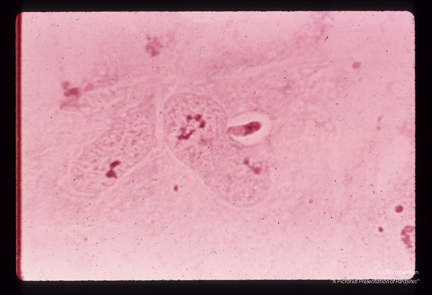 Intracellular sporozoite 12 hours after inoculation. Note the indentation of the host cell nucleus and the eosinophilic posterior refractile globule of the sporozoite. A parasitophoric vacuole surrounds the parasite. H & E stain.