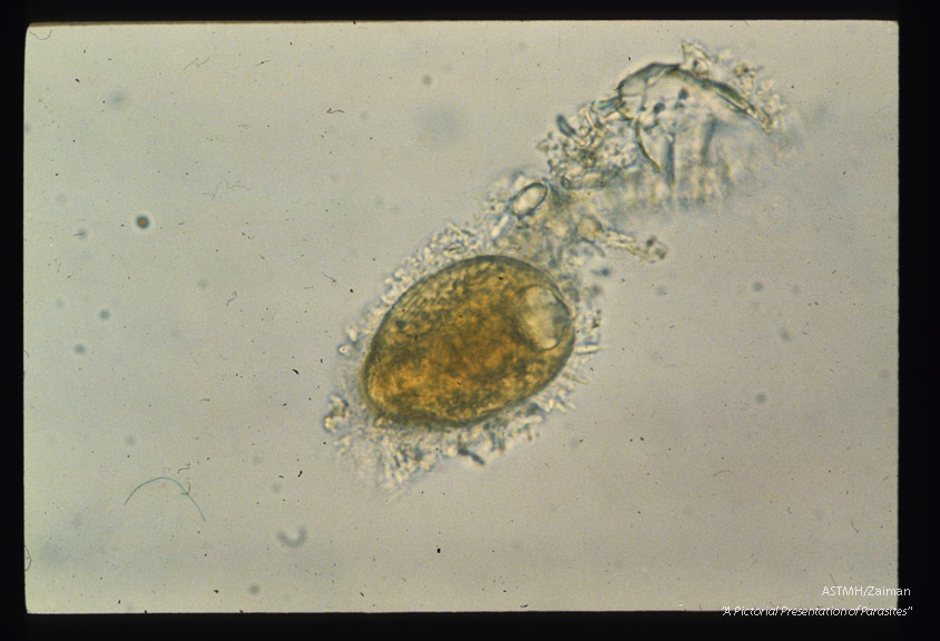 Trophozoite showing cilia and contractile vacuole.